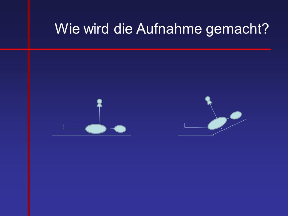 Das Rating der Cremes von der Pigmentation